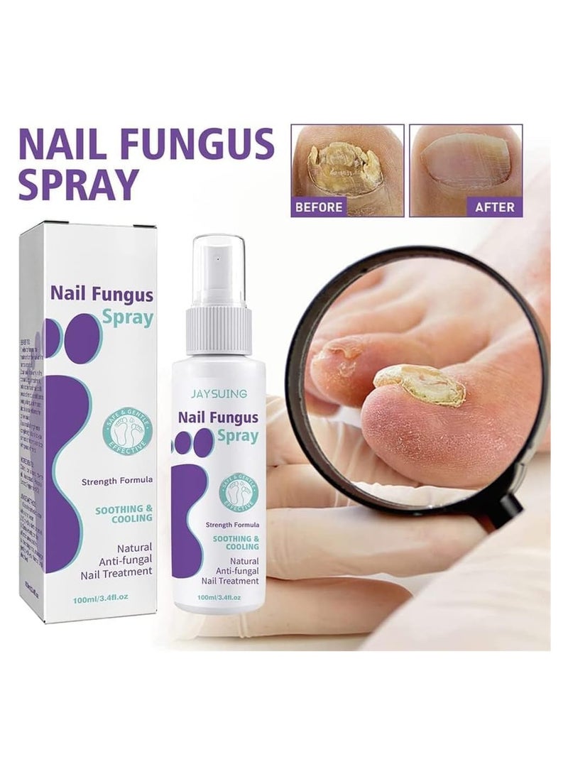 Extra Strong 100ML Toenail Fungus Treatment Spray Effective Nail Softener and Toe Nail Care Solution