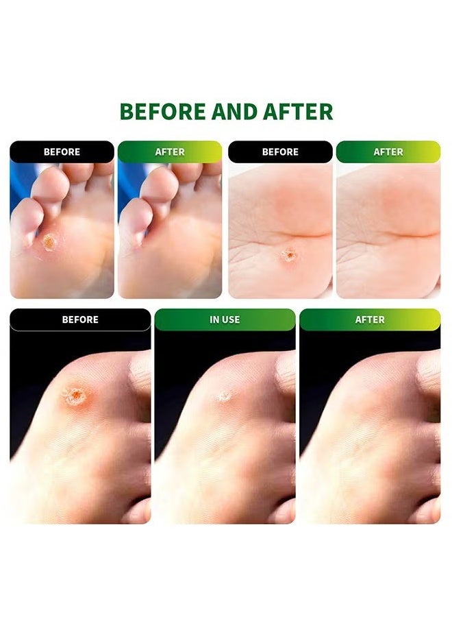 سوميفون 54 قطعة من لاصقات إزالة الكالو، علاج العناية بالقدم للكالو والكالو، لاصق إزالة الكالو للقدم، تخفيف الألم الناتج عن الكالو، والكالو، والبثور، وفرك الكعب - Image 2