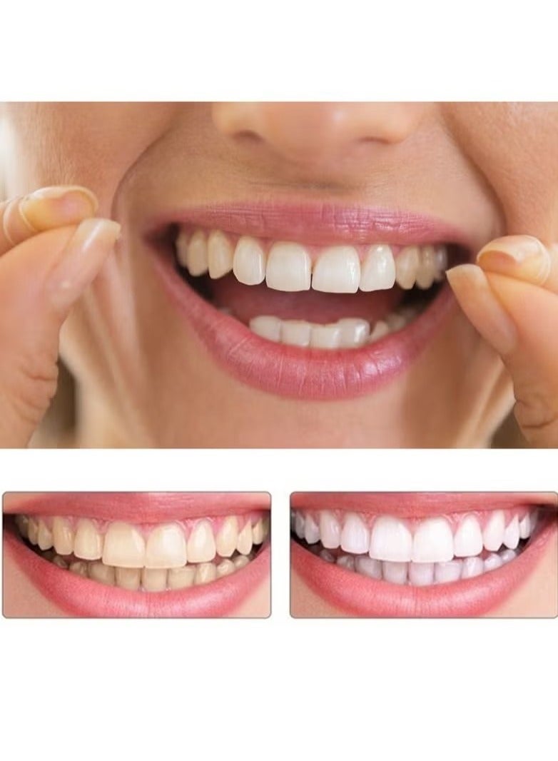 Coconut Teeth Veneers Anti-true Braces Snap On Smile Teeth Whitening Denture Teeth Comfortable Veneer Cover Teeth  - Image 5