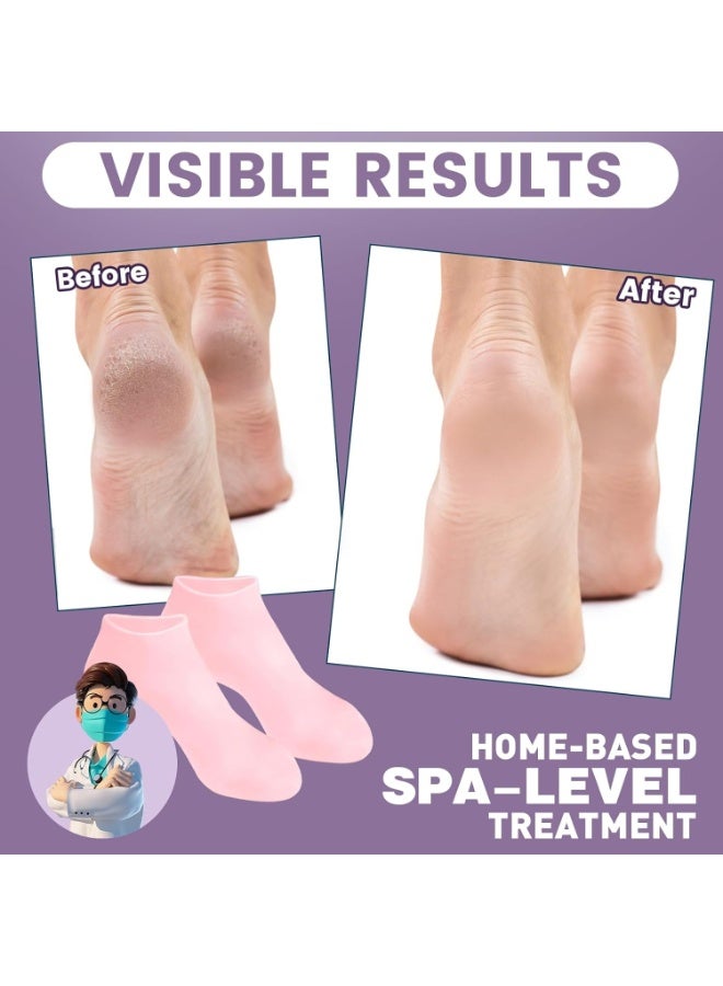 جوارب ترطيب وتغذية القدمين للنساء – جوارب سيليكون هلامية للعناية بالقدمين والجفاف والتشققات – تحتوي على زيت الجوجوبا وفيتامين E وزيت الزيتون وزيت الورد – علاج تشقق الكعبين وتقشير الجلد الميت – جوارب منزلية للسبا والعناية الذاتية – هدية مثالية للأم ومناسبة لجميع النساء – قابلة لإعادة الاستخدام ومناسبة لجميع مقاسات القدمين - Image 5