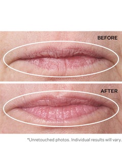 Strivectin StriVectin Anti-Wrinkle Double Fix for Lips Plump & Smooth Vertical Lines, Hydrating Two-in-One Treatment, 0.16 Fl O  - Image 5