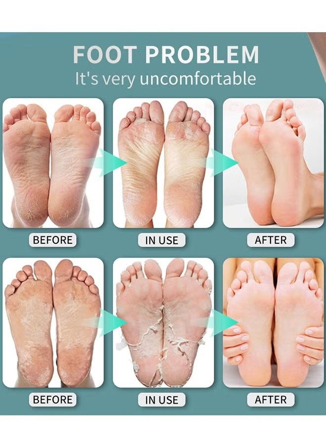 lansiyi - Foot Bacteria Bacteriostasis Spray, Shoe Deodorizer Foot Spray Odor Smell Eliminator Freshener For Athlete Sweat Feet Skin Repair, Natural Ingredients Soothe And Feet Itchy Care Spray - Image 1
