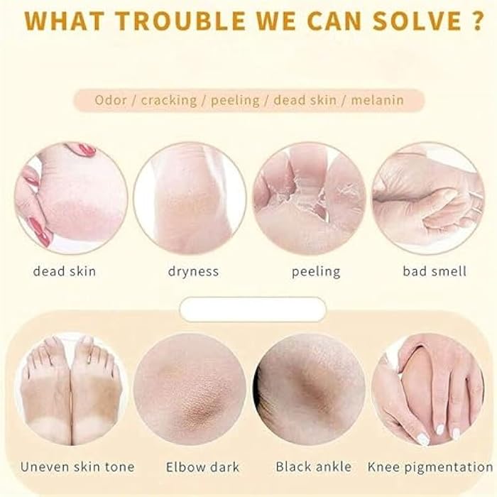 Step towards your feet for optimal suppleness with soft feet, effortlessly, and get rid of dry, dark elbow and knee with ease, 2-3 applications - Generic - Image 4