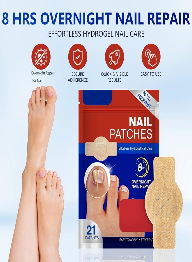 JD PRO | 21 PCS Fungal Nail Patches, Ingrown Toe Nail Remover, Nail Revitalizing Patches Overnight Nail Support for Damaged Nails May Assist Comfortable and Discreet Easy to Apply and Remove.| - Image 2