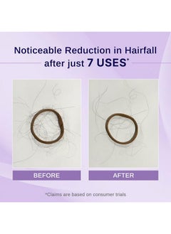 BARE ANATOMY Bare Anatomy Nature x Science Rosemary Hibiscus Hair Growth Oil for Women & Men | Promotes New Hair Growth & Strengthens Hair | Nourishes Scalp & Controls Hair Fall | Suitable for All Hair Types-100ml  - Image 3