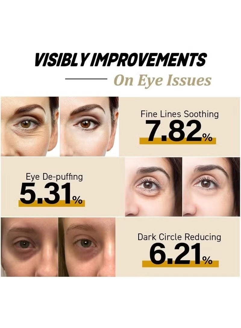Hoygi Eye Cream for Dark Circles, Advanced Snail Repair Eye Stick with Snail Mucin, Hydrating Cream for Puffiness and Bags Under Eyes, Reduces Fine Lines and Wrinkles - Image 5