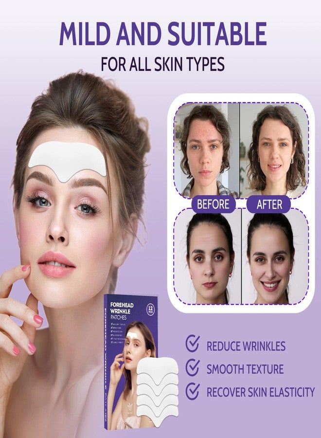 GYSION لصقات تجاعيد الجبهة - 12 قطعة من لصقات الكولاجين المضادة للشيخوخة لعلاج خطوط العبوس، ومخفف تجاعيد الوجه الليلي مع حمض الهيالورونيك وفيتامين هـ، لتنعيم الخطوط الدقيقة وتجاعيد الجبهة. - Image 3