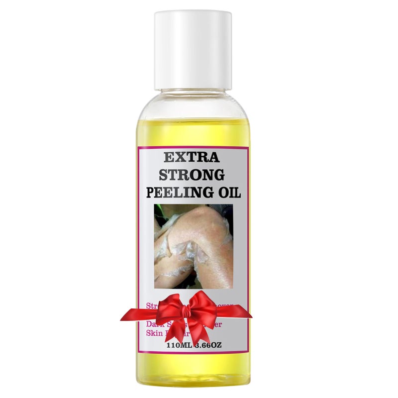 YAFUSIPE Yellow Peeling Oil for Dark Skin Strong Peel Oil Extra Strength Exfoliating Chemical Exfoliant Peels Solution at Home Body Peeling for Exfoliate Body Hand Foot Knuckle All Skin Type 3.66 OZ - Image 1