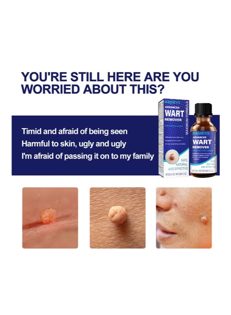 AIJIEYO Maximum Strength Wart Removal Fluid - Fast Acting Formula for Plantar & Common Warts | Natural & Safe Treatment for Most Body Warts - Image 4