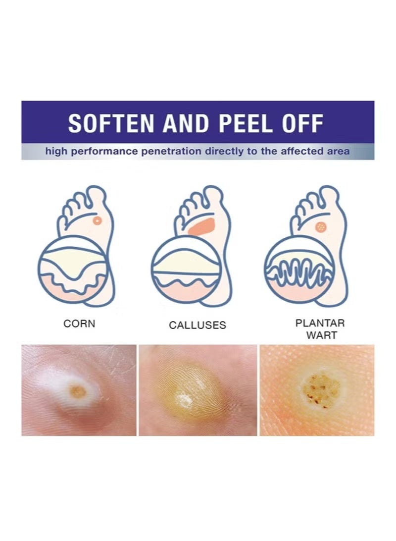 AIJIEYO Maximum Strength Wart Removal Fluid - Fast Acting Formula for Plantar & Common Warts | Natural & Safe Treatment for Most Body Warts - Image 5