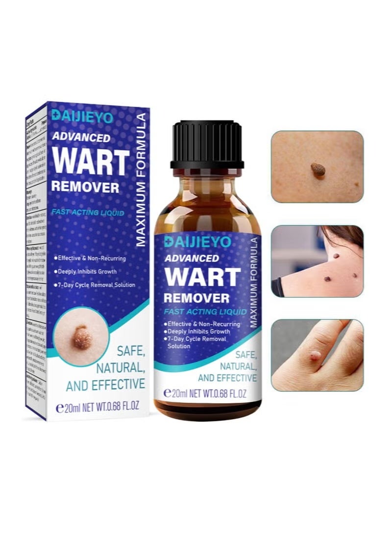 AIJIEYO Maximum Strength Wart Removal Fluid - Fast Acting Formula for Plantar & Common Warts | Natural & Safe Treatment for Most Body Warts - Image 3