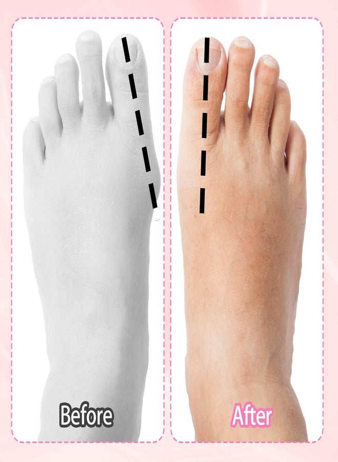 WJIAAA Toe Stretcher Bands Set of 5, Bunion Correction Foot Big Toe Spacers with Carry Bag, Resistance Loop Bands for Women Men Hallux Valgus Foot Yoga Toes Alignment Exercise - Image 3