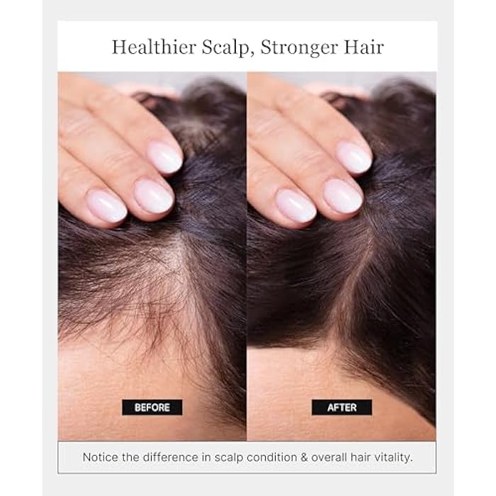 keracell Invigorating Shampoo - Hair Growth Shampoo for Women & Men with Human Stem Cell Extract – Cleanses, Strengthens & Moisturizes to Support a Healthier Scalp & Fuller-Looking Hair - 8 oz - Image 5