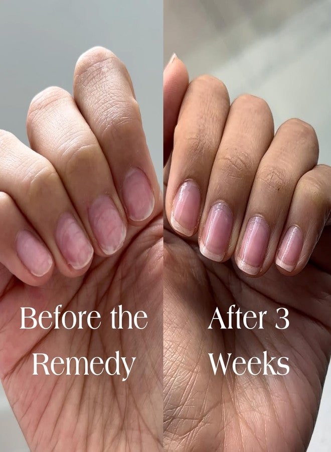 Botanist Nails Botanist The Remedy | Nail Strengthening Polish | Repairs & Hardens Nails Damaged from Acrylics, Dip & Gel Manicures | Non-Toxic, 84% Plant Based, 21-Free & Vegan (Rose) - Image 4