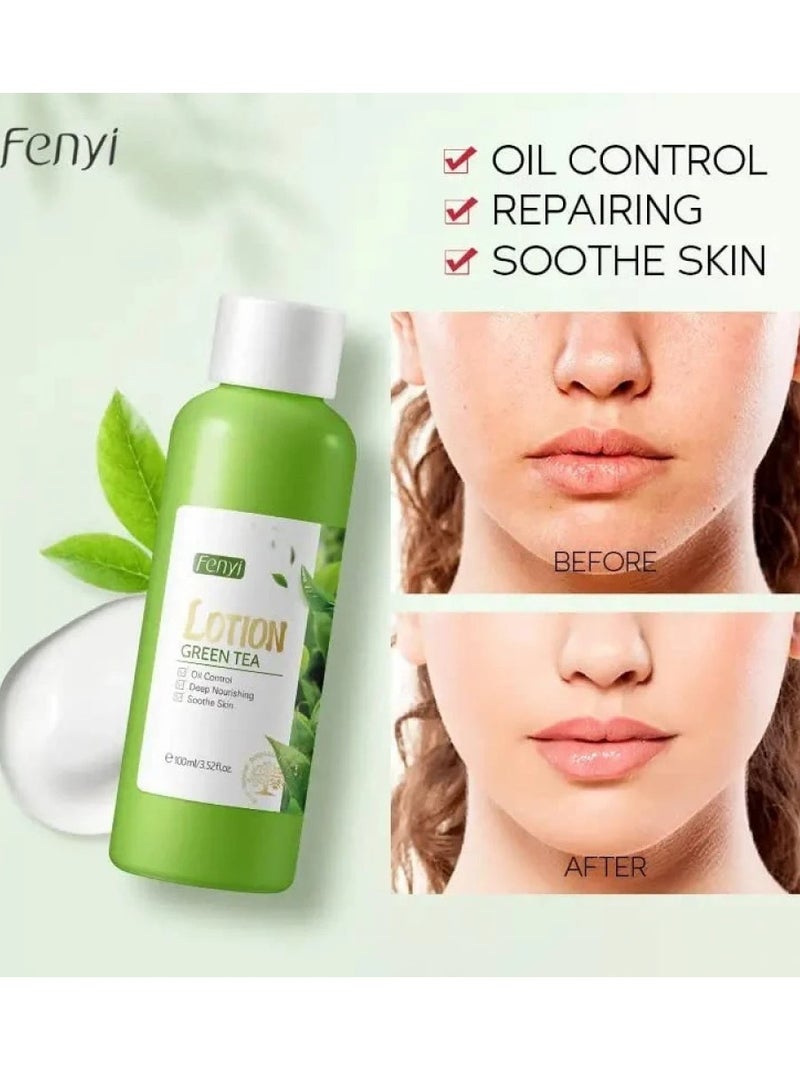 فيني لوشن الشاي الأخضر، ترطيب عميق وتحكم في الزيوت، عناية مزدوجة لبشرتك، 100 مل - Image 1