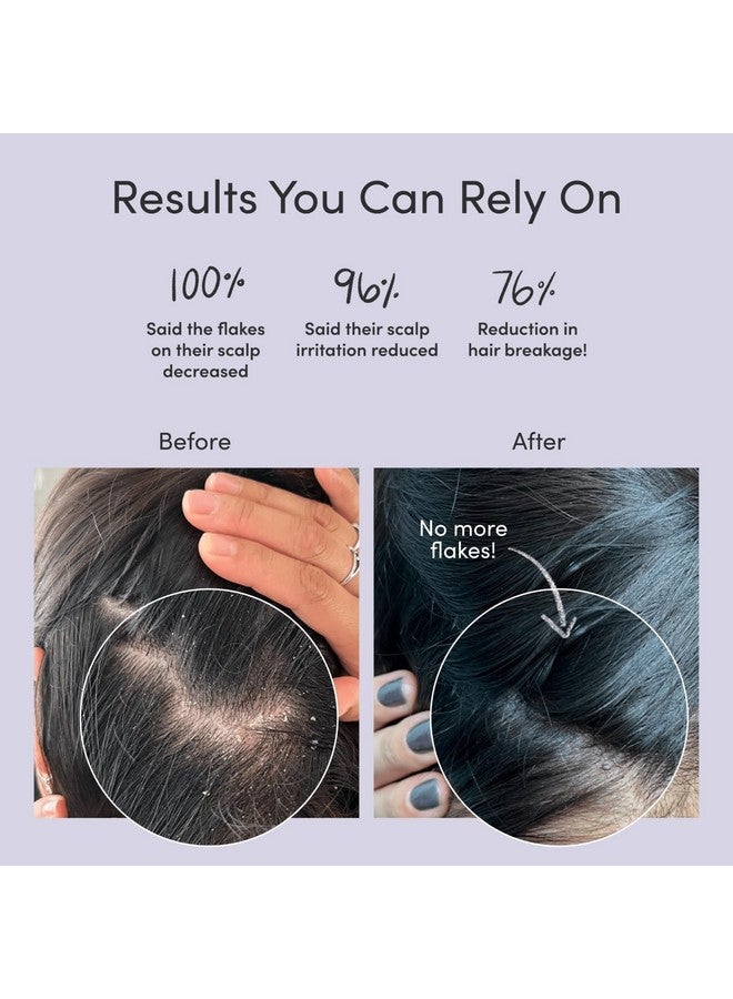 Jupiter Anti Dandruff Shampoo For Women & Men - Physician-Formulated For Flaky, Itchy, Oily, Dry Scalp - Vegan, Sulfate Free - Color Safe & Paraben Free Anti-Dandruff Shampoo With Zinc - 9.5 fl oz - Image 2