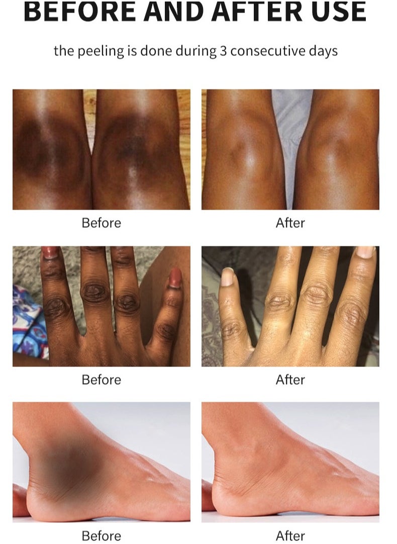 MOOYAM Peeling Oil for Dark Skin, Green Extra Strength Exfoliating Body Peeling Oil, Chemical Peel Solution for Hands and Feet, Effective Exfoliation for Smooth and Radiant Skin  - Image 5