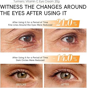 Vitamin C Turmeric Eye Cream for Dark Circles and Puffy Eyes Moisturizing Under Eye Brightener Lightweight AntiAging Skincare for All Skin Types - Image 3