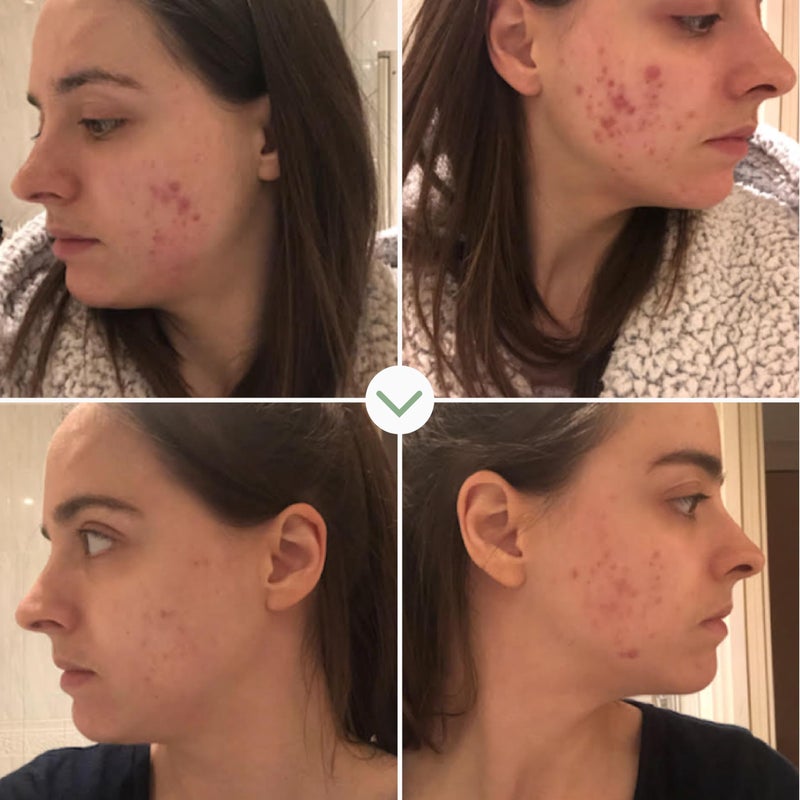 Pai Skincare - Organic Instant Kalmer Sea Aster + Schisandra Ceramide Serum | Natural, Vegan, Sensitive Skincare (1 fl oz | 30 mL) - Image 5