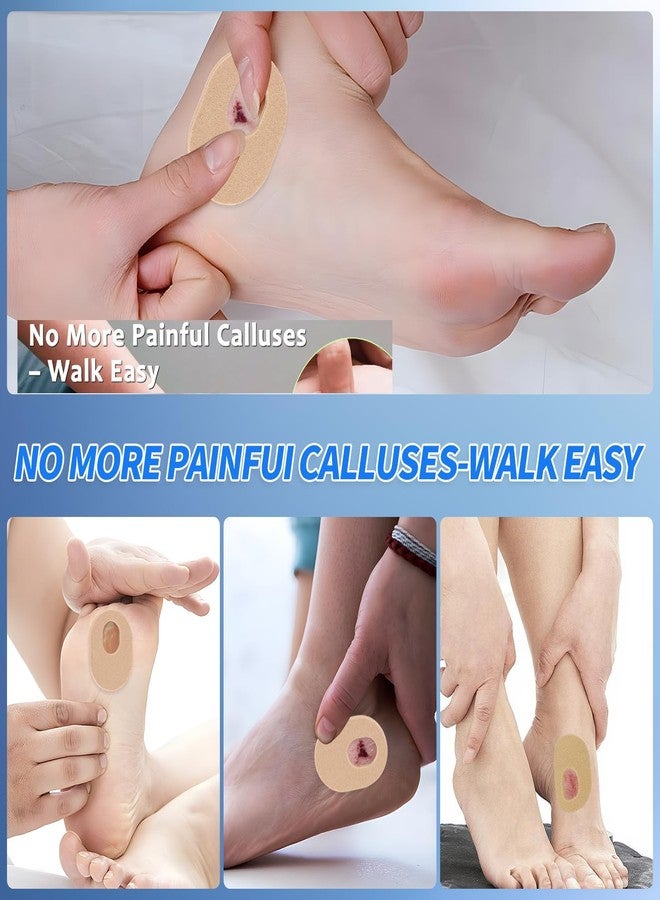 Bolsdoic 48 Pack Callus Pads，Soft Felt Callus Cushion Pads for Relief Foot Pressure and Heel Pain,Hollow Design Self-Adhesive Foot Callus Pads - Image 5