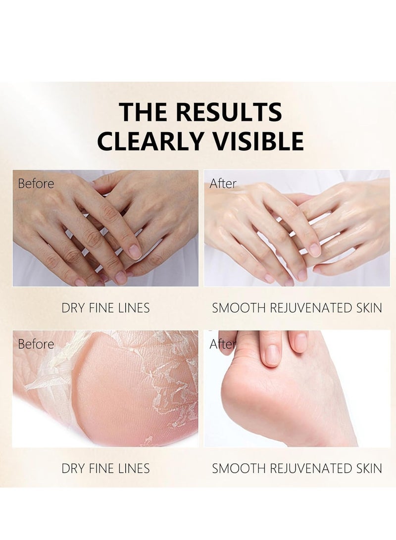VSEA Hand Masks,Hydrating Moisturizing Hand Mask for Dry Hand,Hydrating Mask for Dry Cracked Hand,5 Pack Glove Mask for Women - Image 3