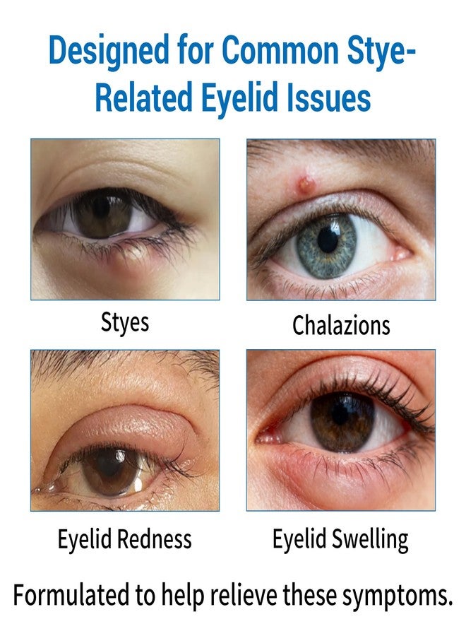 Stye Eye Treatment 2 Kits, Serum & 10 Pcs Stye Eye Relief Compress Mask - Image 5