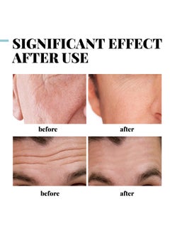 EELHOE COLLAGEN Cream, Men'S Anti-Aging Cream With 5% HYDROLYZED  COLLAGEN, Retinol, Hyaluronic Acid and Vitamin E, Hyaluronic Acid Moisturising Cream, Reduces The Appearance Of Wrinkles, Fine Lines And Dryness on the Face, Moisturising, Whitening and Nourishing 50 g  - Image 5