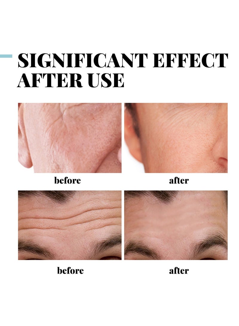 إيلهو كريم كوللاجن، كريم مضاد للشيخوخة للرجال يحتوي على 5% كوللاجن هيدروليزيد، ريتينول، حمض الهيالورونيك وفيتامين E، كريم مرطب بحمض الهيالورونيك، يقلل من ظهور التجاعيد والخطوط الدقيقة والجفاف على الوجه، مرطب ومبيض ومغذي - Image 5