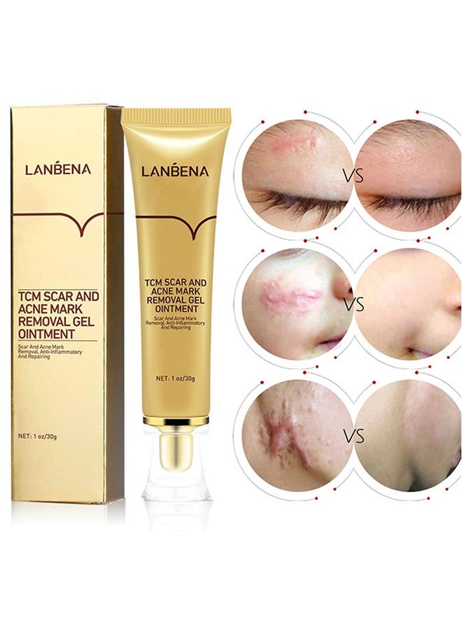 LANBENA Skin Care Gel,Herbal repair scar cream 30g, scar gel, skin repair gel, natural plant ingredients, effectively repair old and new scars, burns, stretch marks, acne, sunburn (30g) - Image 2