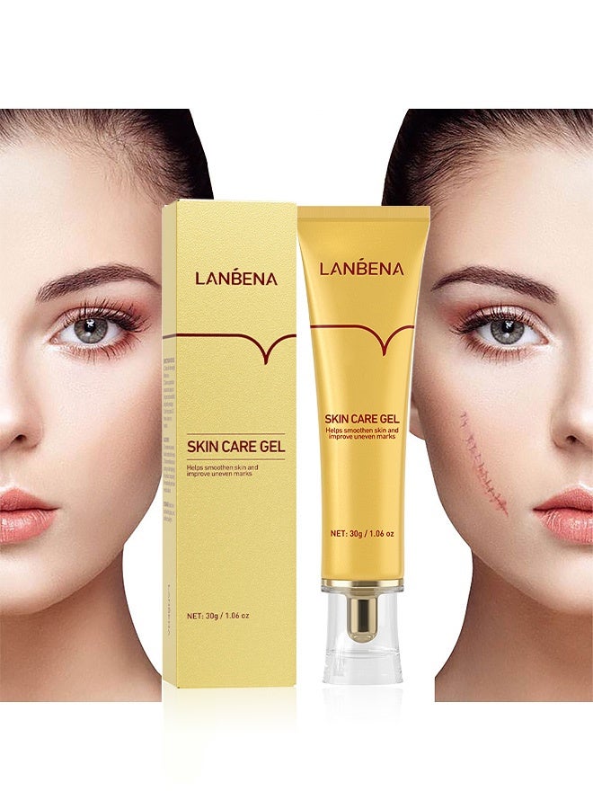 LANBENA Skin Care Gel,Herbal repair scar cream 30g, scar gel, skin repair gel, natural plant ingredients, effectively repair old and new scars, burns, stretch marks, acne, sunburn (30g) - Image 1
