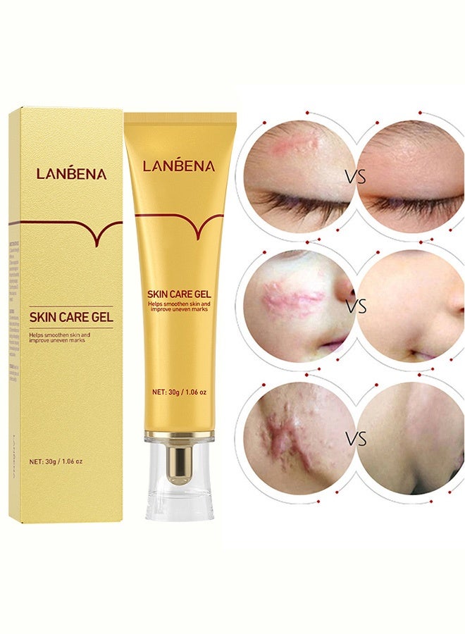 LANBENA Skin Care Gel,Herbal repair scar cream 30g, scar gel, skin repair gel, natural plant ingredients, effectively repair old and new scars, burns, stretch marks, acne, sunburn (30g) - Image 2