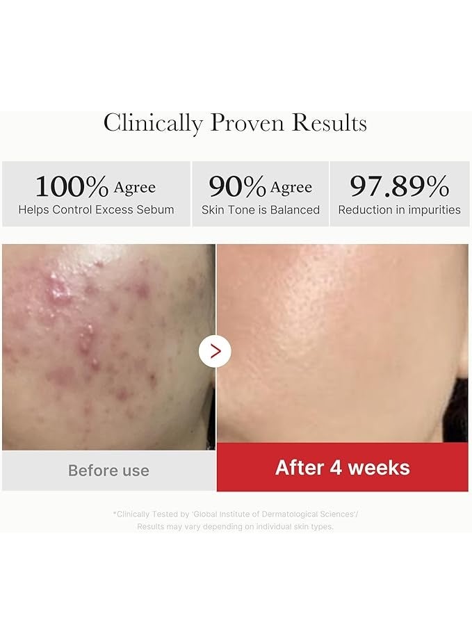 ميديكيوب ميديكوب وسادات تقشير الوجه بحمض السكسينيك والبانثينول الأحمر - وسادات تونر لتقشير البشرة المعرضة للكسر مع النياسيناميد، AHA، BHA، والبانثينول المهدئ - لا يسبب الكوميدوغينيك - Image 3