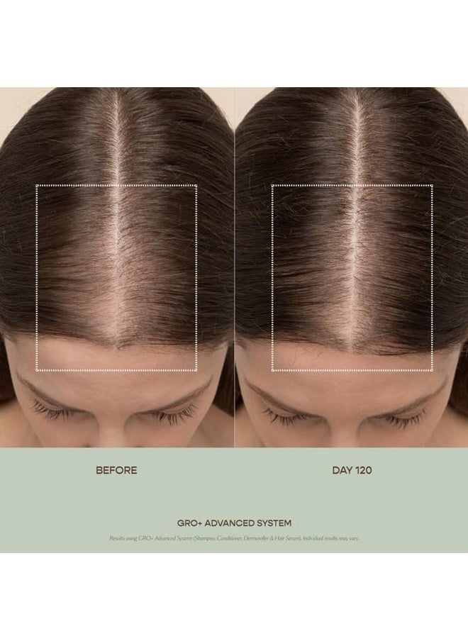 VEGAMOUR - VEGAMOUR GRO+ Advanced Hair Serum for Improving Hair Density, Reduces Shedding and Promotes a Healthy Scalp, 1 pack - Image 1