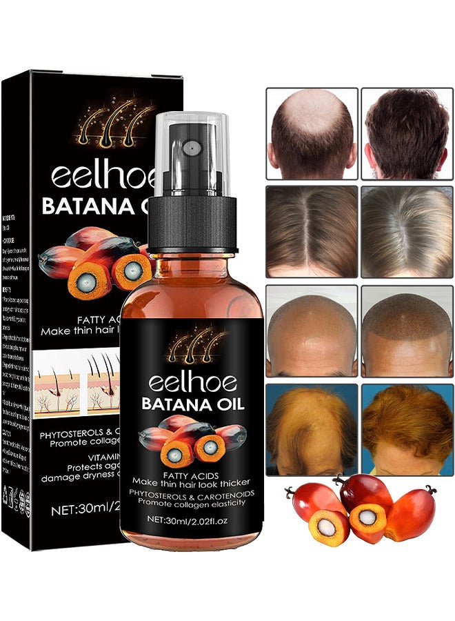 EELHOE Batana Oil For Hair Growth, Batana Oil Organic For Healthy Hair, Repair Damaged Hair, Nourishes Thin Hair Scalp Skin And Loss Hair Growth Fir, Reduces Hair Loss, 30ML - Image 1