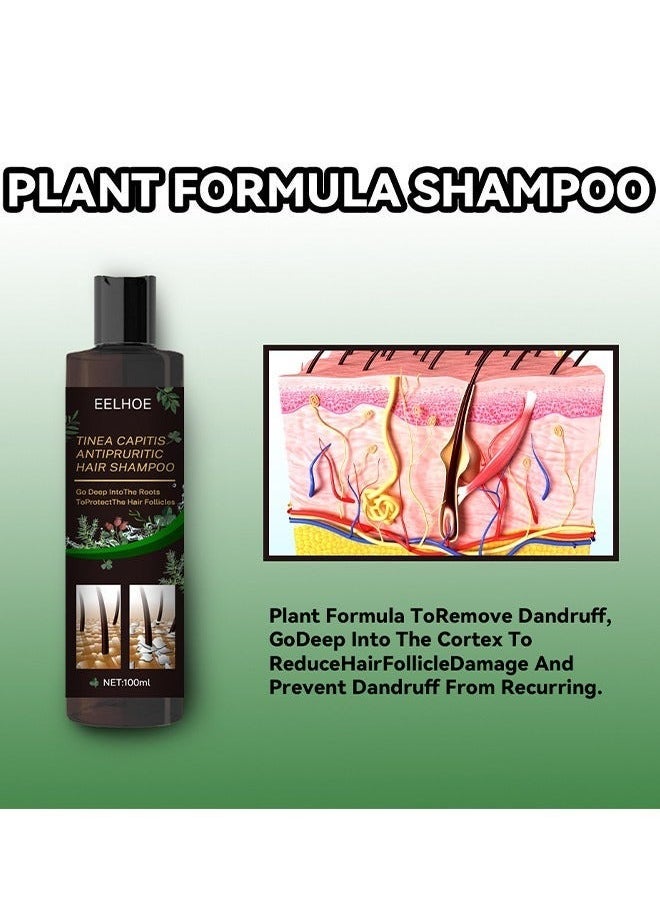EELHOE شامبو الشعر المضاد للحكة لقشرة الرأس، شامبو مضاد للقشرة، شامبو لفروة الرأس المعرضة لالتهاب الجريبات الشعرية، التهاب الجلد، القشرة، العث، فروة الرأس الحاكة والمتقشرة، يعالج القشرة والتهاب الجلد الدهني - Image 5