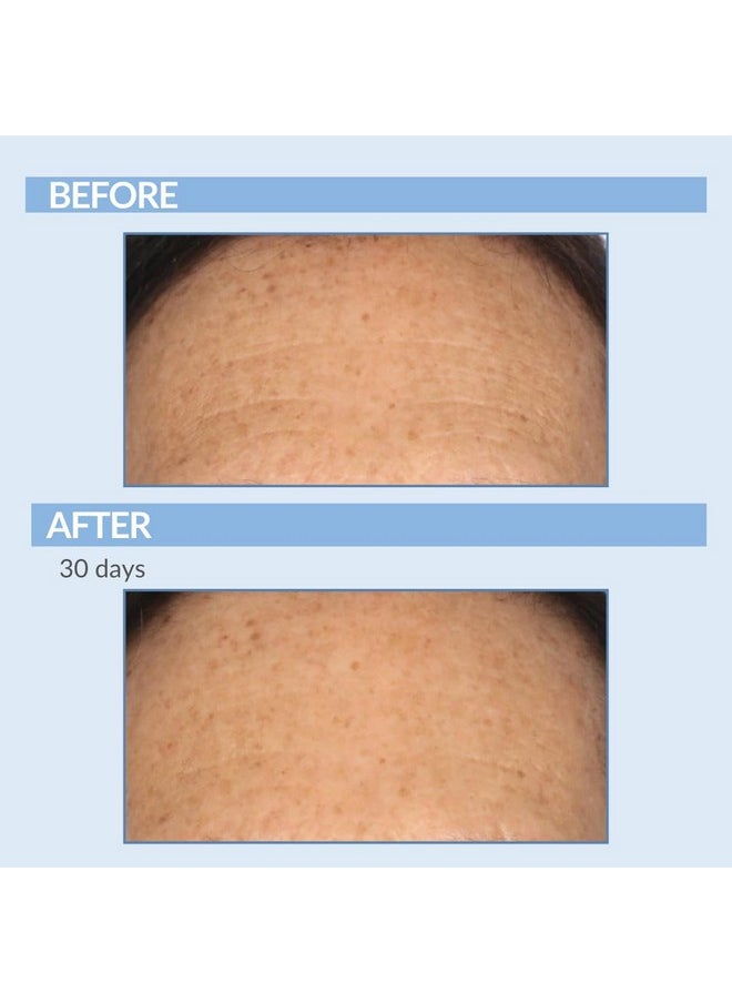 Serious Skincare - Serious Skincare A Defiance - Vitamin A Retinol Treatment Pads - Anti-Aging for Lines, Wrinkles, Dark Spots - Skin Resurfacing Cushions for Facial Radiance - 60 Count - Image 1