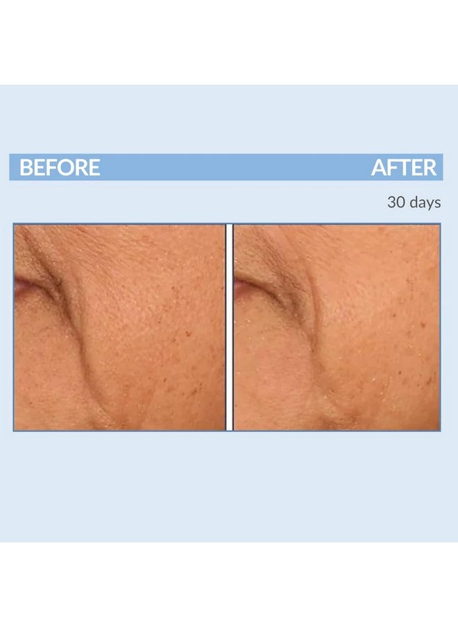 Serious Skincare - Serious Skincare A Defiance - Vitamin A Retinol Treatment Pads - Anti-Aging for Lines, Wrinkles, Dark Spots - Skin Resurfacing Cushions for Facial Radiance - 60 Count - Image 1
