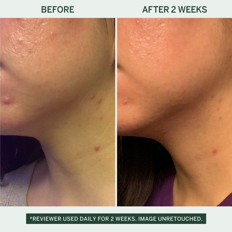 FACETORY Urban Calm Barrier Cream Hydrating Face Moisturizer with Hyaluronic Acid & Fermented Honeybush, Daily Moisturizer Face Cream for Aging, Dry Skin & Sensitive Skin 1.69 Fl Oz - Image 3