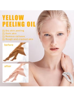 OUHOE 100ml Super Strength Yellow Peeling Oil Exfoliating Dark Skin for Body, Yellow Peeling Oil Body Whitening Skins, Butter Peeling Lightening Brighten Complexion for Cleansing and Moisturizing  - Image 2