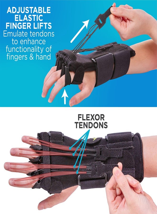 BraceAbility Radial Nerve Palsy Splint - Dynamic Wrist Drop Splint for Limp Finger Wrist Extension, Saturday Night, Honeymoon, Crutch Palsy, Stroke Recovery Brace - Fits Right or Left Hand (One Size) - Image 3