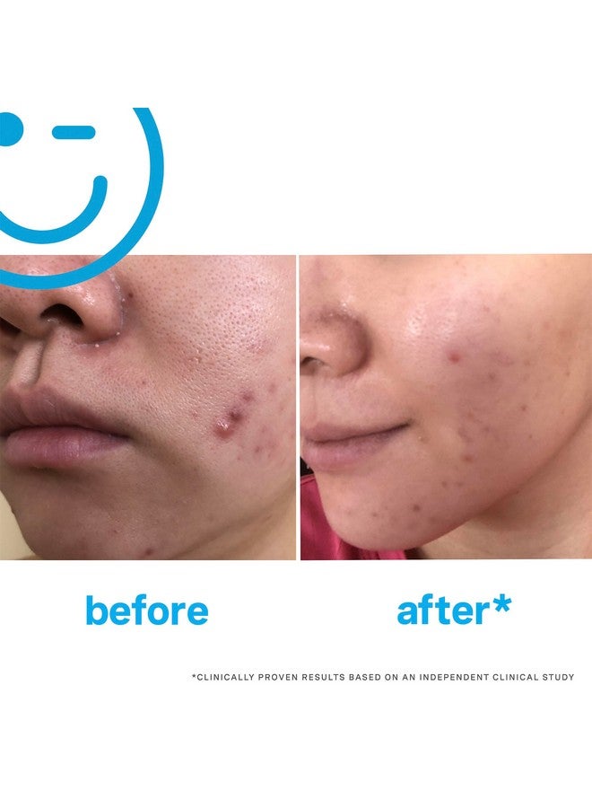 Kate Somerville EradiKate 3% Sulfur Daily Foaming Cleanser Acne Treatment - Clinically Formulated Medicated Face Wash Balances Skin and Cleans Pores, 4 Fl Oz - Image 2