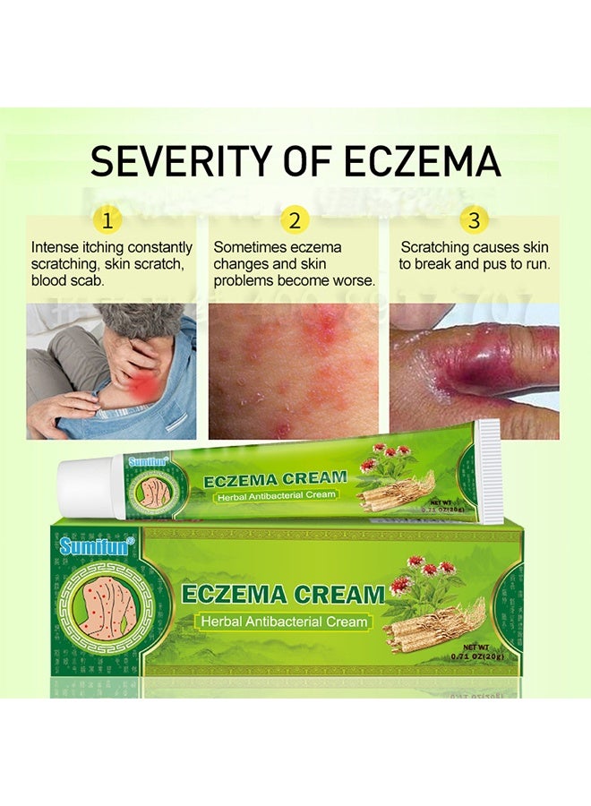 Sumifun Herbal Antibacterial Eczema Cream 20g, Dermatitis and Eczema Pruritus Psoriasis Ointment, Quickly Relives Itching, Daily Ointment for Eczema - Image 5