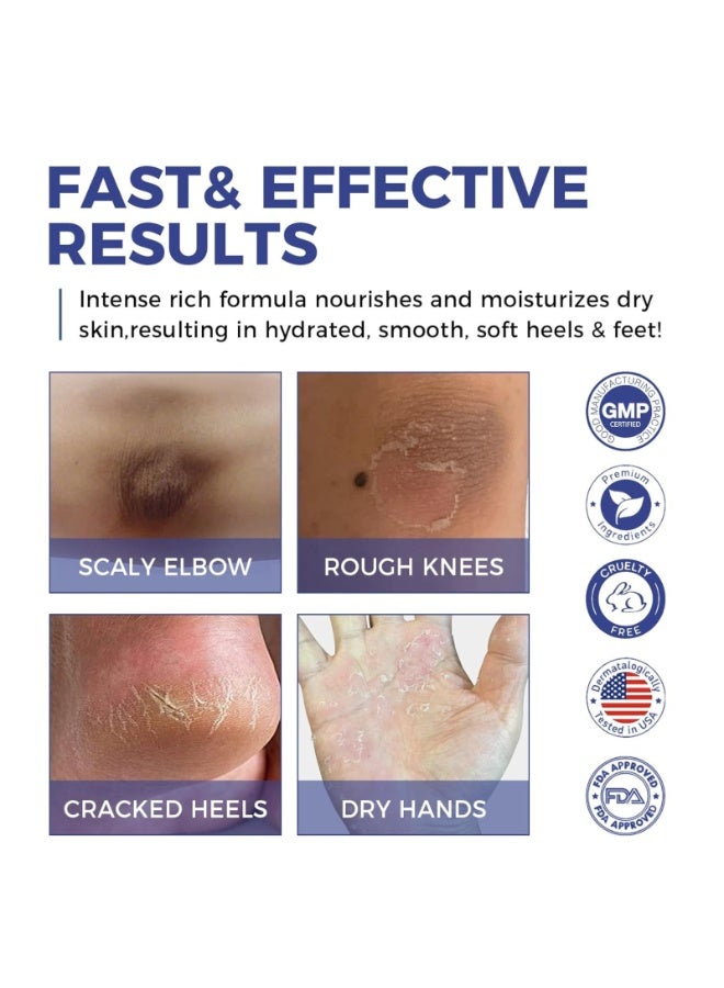 Kanza كريم يوريا 42% بوزن 150 جرام مع حمض الساليسيليك لإزالة الكالو لليدين والقدمين وكريم مرطب للجلد للقدمين المتشققة والكعبين والمرفقين والأظافر والركبتين - Image 5