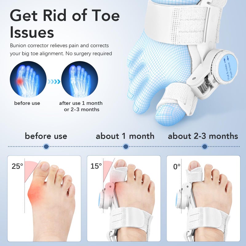 VEVARUN Bunion Corrector for Women Men: Big Toe Straightener Bunion Fix with Adjustable Knob-Orthopedic Bunions Splint Brace Toe Alignment Correction for Hallux Valgus Pain Relief Day/Night (White) - Image 2