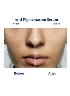 Blue Nectar Blue Nectar Rice Water Kojic Acid Face Serum for Pigmentation & Dark Spots Removal | Anti Pigmentation Serum for Face with Mushroom (13 Herbs, 30ml)  - Image 4