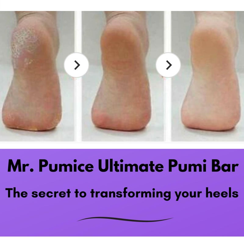 Mr. Pumice بار بوميس النهائي من مستر بوميس 2 في 1 ذو حبيبات مزدوجة (متوسطة + خشنة) لإزالة الجلد الميت، حجر باديكير ومقشر قدم لنعومة القدمين والكعب (4 عبوات) - Image 3