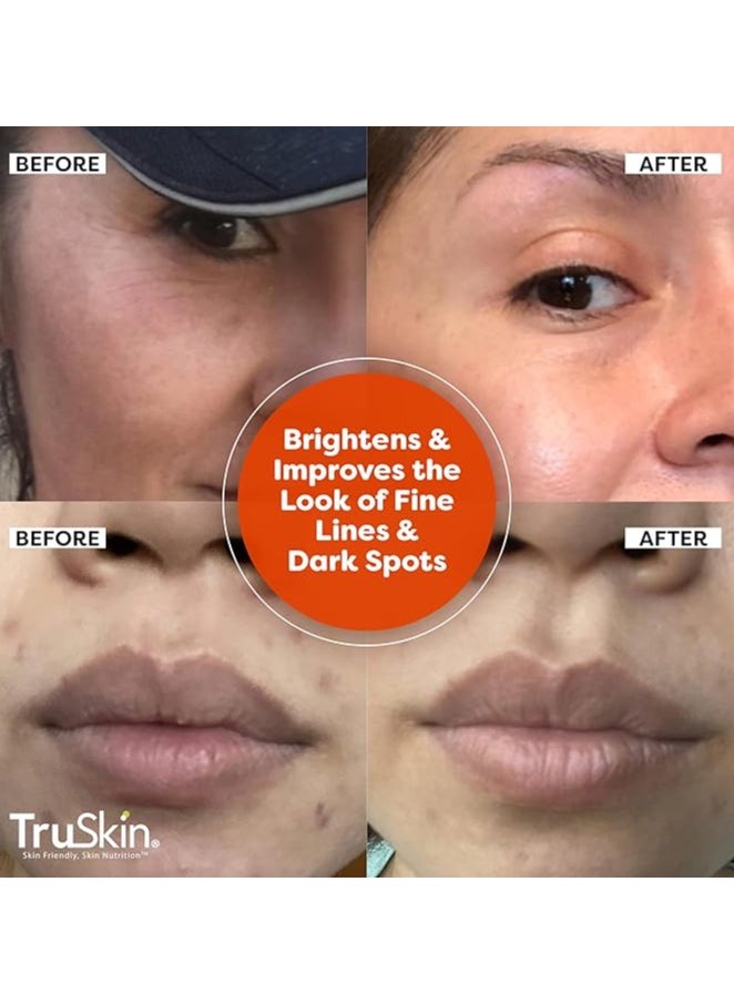 TruSkin TruSkin Vitamin C Serum For Face – Anti Aging Formula with Vitamin C, Hyaluronic Acid, Vitamin E – Brightening Serum – Improve Appearance of Dark Spots, Tone, Fine Lines & Wrinkles, 1 Fl Oz  - Image 3
