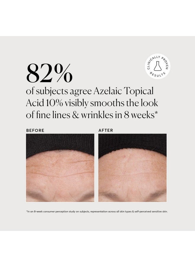 NATURIUM Naturium Azelaic Topical Acid 10%, Face & Skin Care Beauty Treatment with Niacinamide & Vitamin C, 1 oz  - Image 4