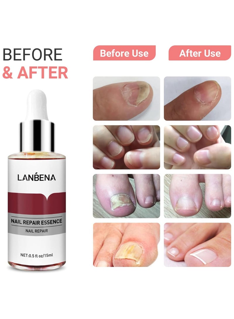 LANBENA Nail Repair Essence Serum, Nail repair, repairs and renews damaged, broken, cracked and discolored nails (15ml)  - Image 3
