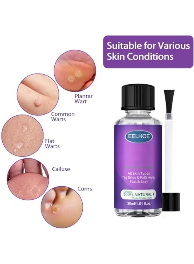 EELHOE Skin Tag Remover, Wart Remover Freeze Off, Fast-Acting Liquid Wart Removal for Plantar, Wart Corn Callus Remover 30Ml(1pcs) - Image 5